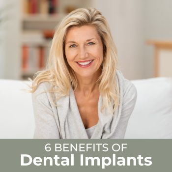 Highland dentist, Dr. Justin Leath at Milford Dental & Associates, shares the benefits of dental implants.