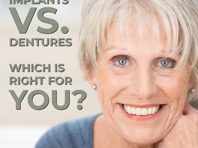 Dental Implants vs. Dentures: Which is Right for You? (featured image)